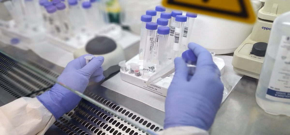 Empresas de Cepa y Caipa aportan recursos para que se hagan testeos gratuitos de coronavirus